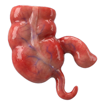 Ícono 3D: Apendicitis