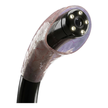 Ícono 3D: Endoscopia
