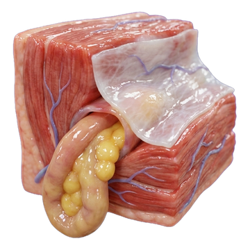 Ícono 3D: Hernia