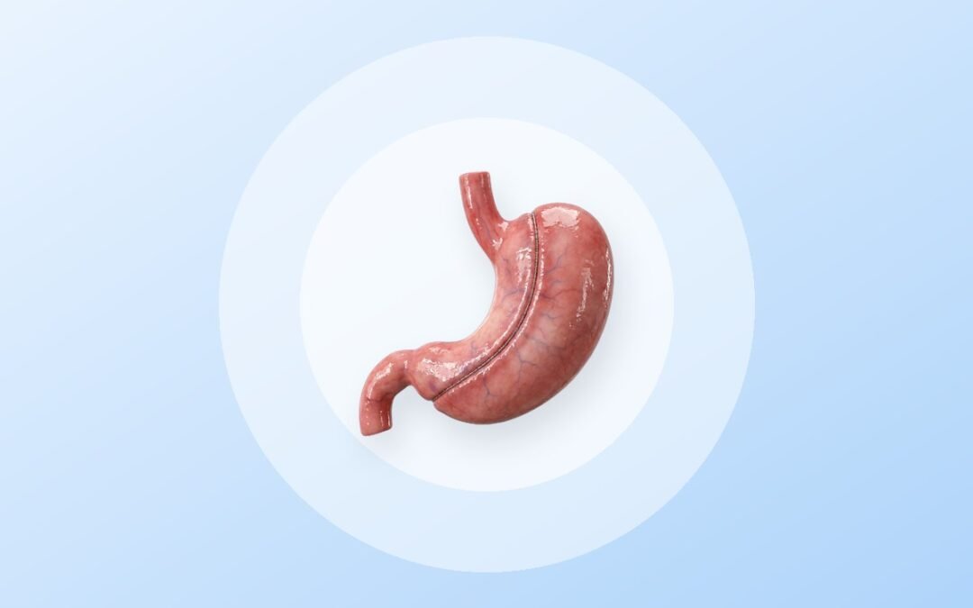 La Importancia de la Cirugía Bariátrica en el Tratamiento de la Obesidad